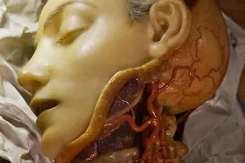 Josephinum, wax model, head